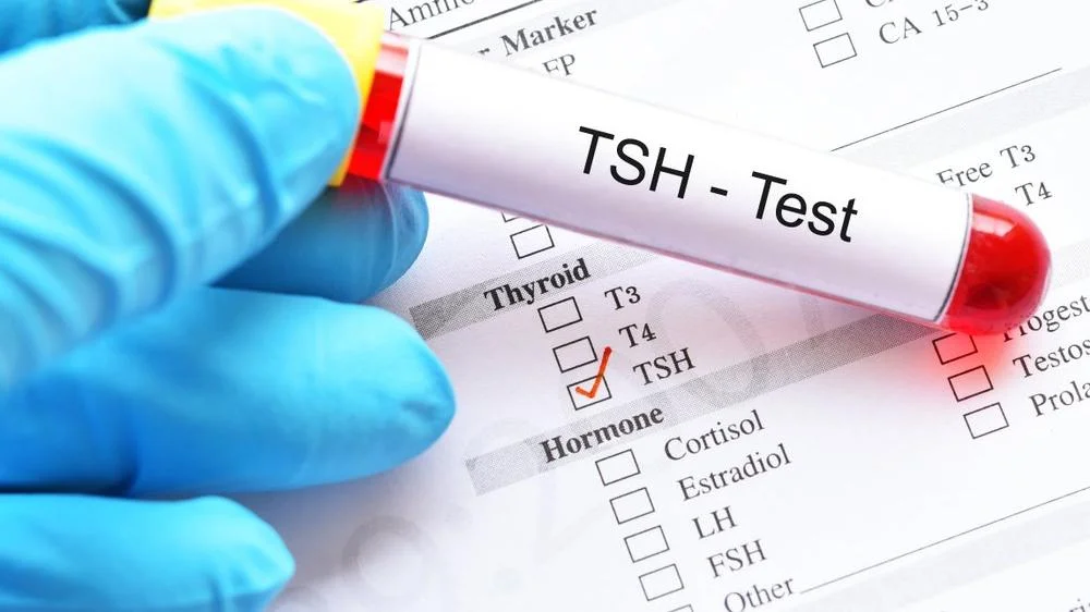 Serbest T4 Nedir? Serbest T4 Düşüklüğü ve Yüksekliği