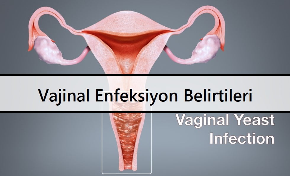 Vajinal Enfeksiyon Nedenleri ve Doğal Tedavi Yöntemleri