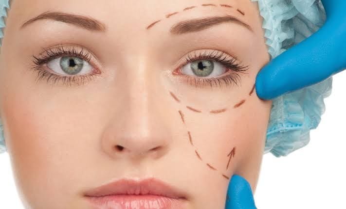 Göz Kapağı Estetiği (Blefaroplasti) Nedir? Nasıl Yapılır?