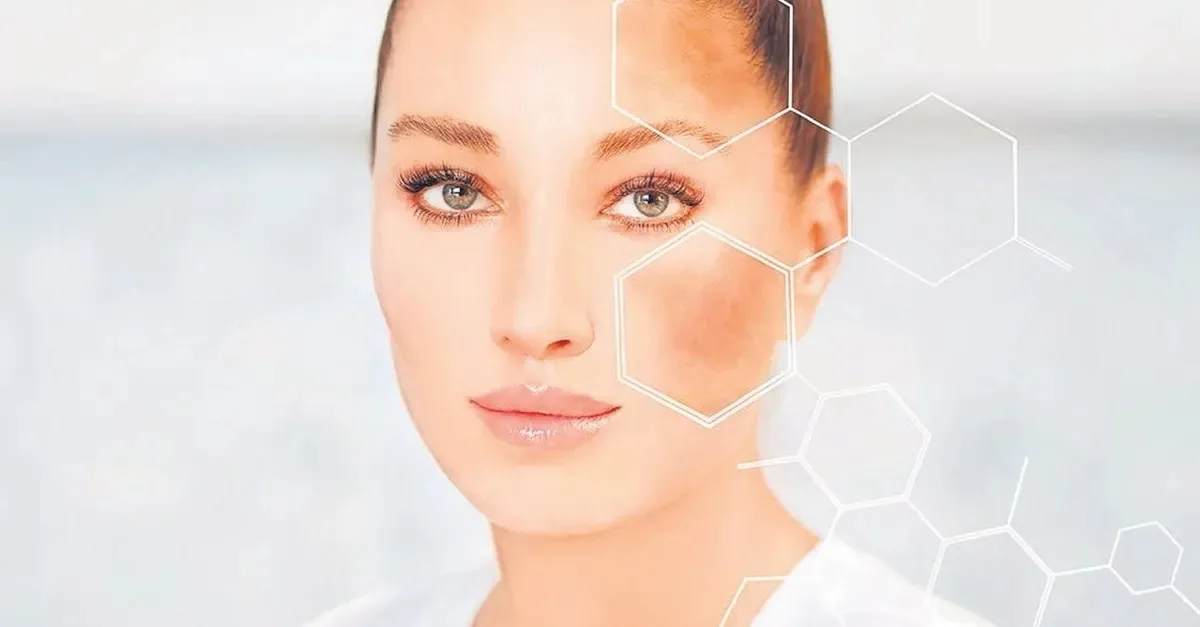 Güneş Lekeleriyle Mücadele: Leke Karşıtı Bakım ve Koruma Rehberi